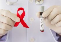 Dấu hiệu HIV cần phát hiện sớm - Nguyên nhân, cách điều trị