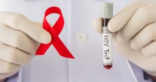 Dấu hiệu HIV cần phát hiện sớm - Nguyên nhân, cách điều trị