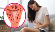 quan hệ xong bị đau bụng dưới ở nữ