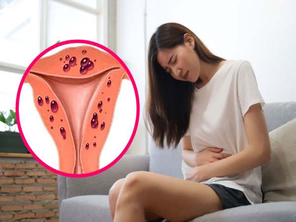 quan hệ xong bị đau bụng dưới ở nữ