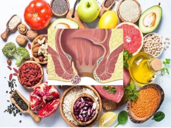 Vì sao chế độ ăn ảnh hưởng đến bệnh trĩ