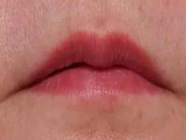 Ý nghĩa môi thuyền úp ở nữ giới Ý nghĩa môi thuyền úp ở nữ giới