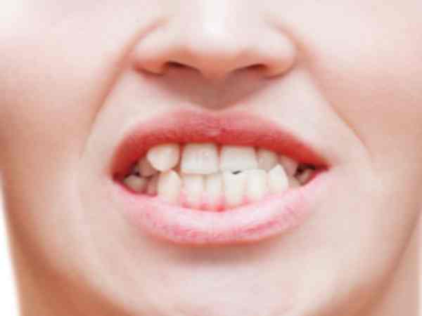 Ý nghĩa tướng răng chó nói chung